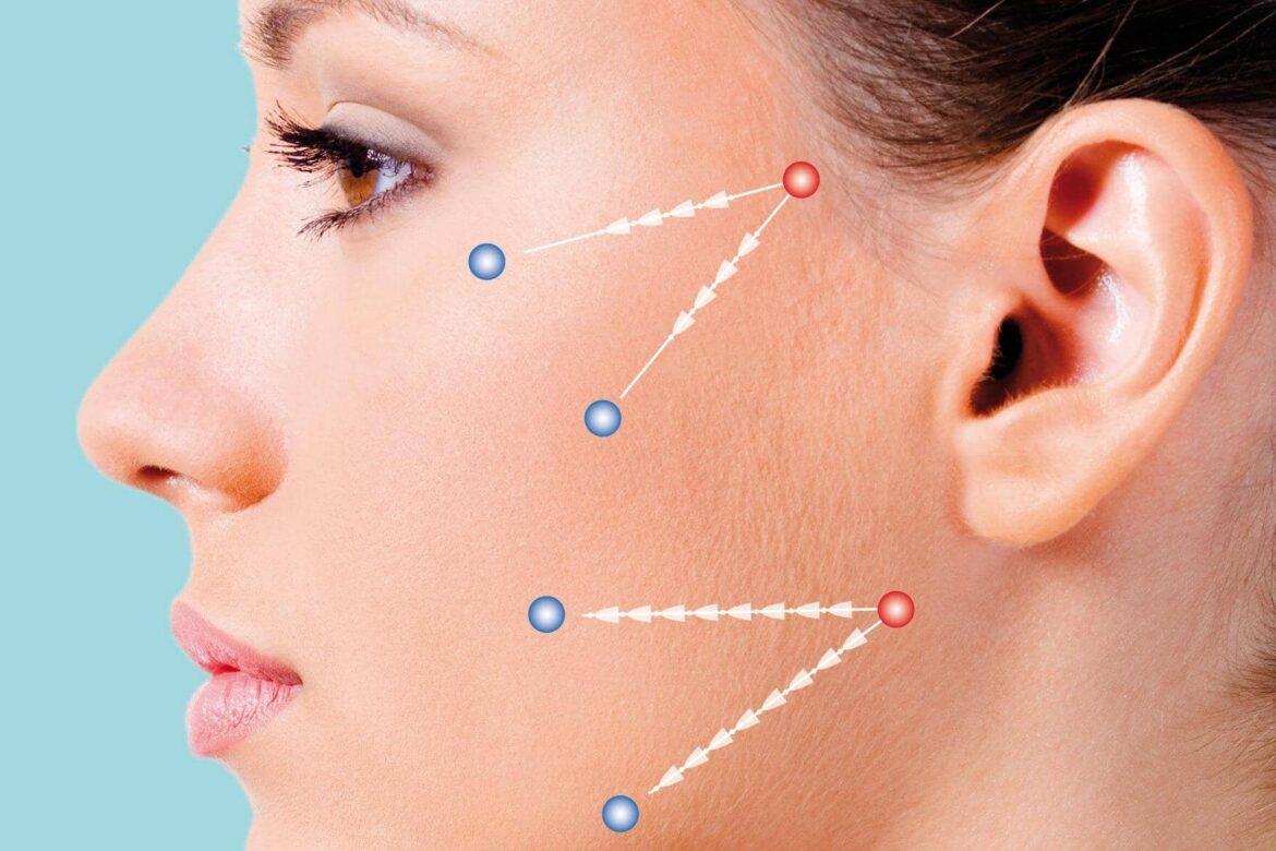 Galería hilos tensores 2