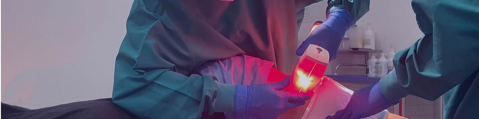 Tratamiento de várices - Portada